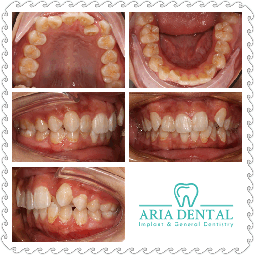 Aria Dental Center